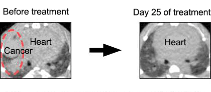 Fig.£²¡¡Therapeutic experiment of mice expressing EML4-ALK