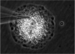 図4 ヒト初代培養肝細胞内の薬物成分捕捉